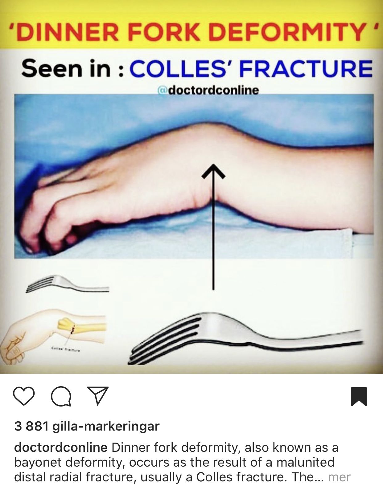 pin by tarne leng on orthopaedics human anatomy and physiology remedial massage all nurses massage therapist schools on pin by tarne leng on orthopaedics human anatomy and physiology remedial massage all nurses