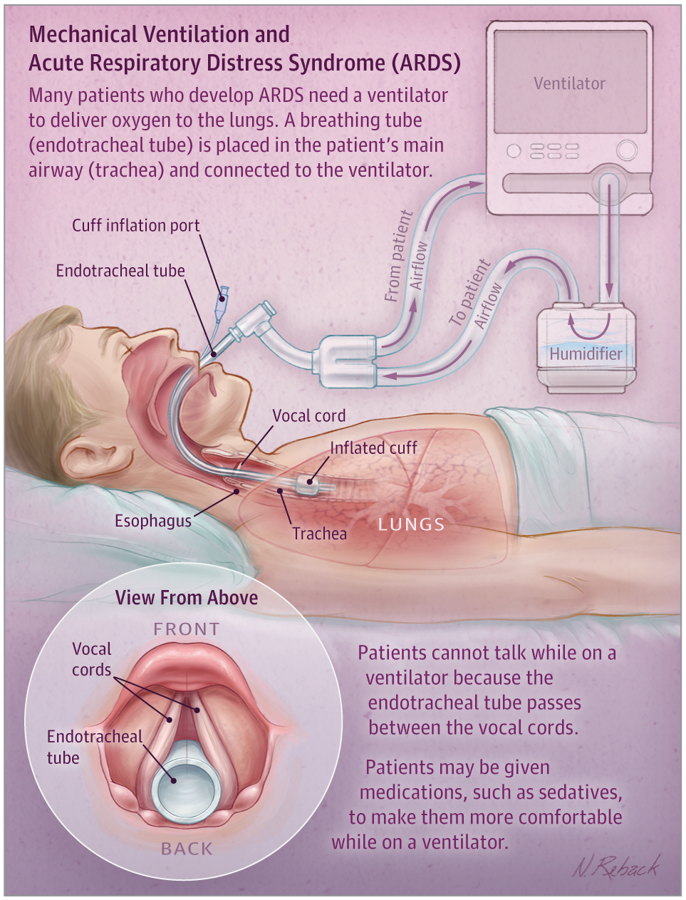 respiratory therapist training on 26 respiratory ideas respiratory acute respiratory distress syndrome respiratory therapy